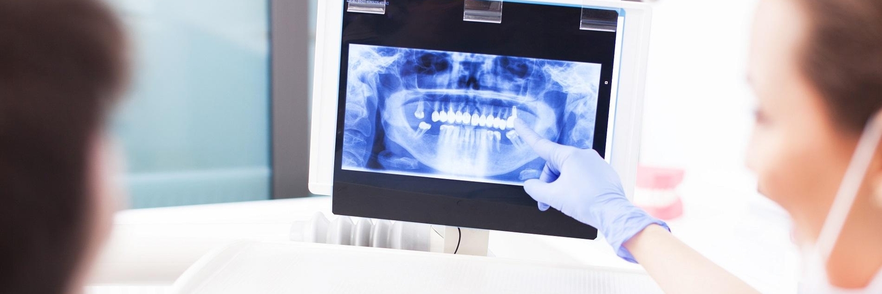 Digital Dental X-Rays | Dentist