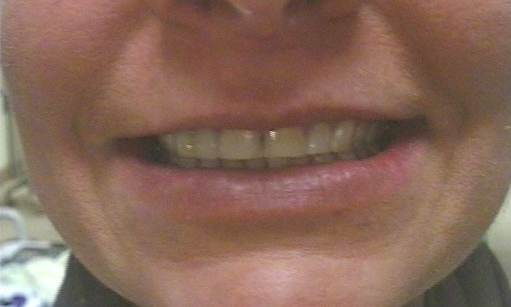Before